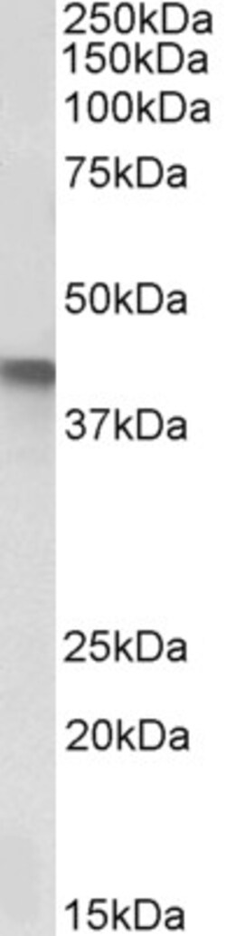 Invitrogen SERPINB1 Polyclonal Antibody 100 &mu;g; Unconjugated:Antibodies,