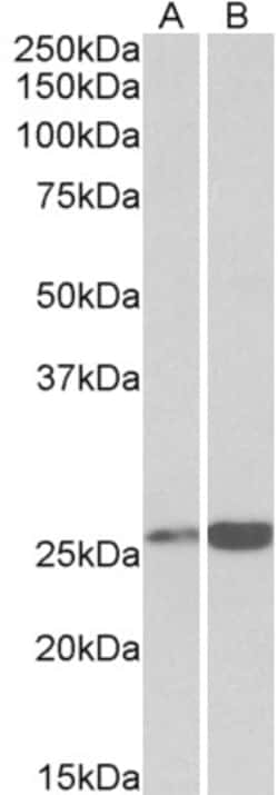 Invitrogen PRDX6 Polyclonal Antibody 100 &mu;g; Unconjugated:Antibodies,