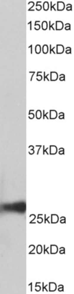 Invitrogen PRDX6 Polyclonal Antibody 100 &mu;g; Unconjugated:Antibodies,