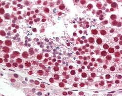 Invitrogen hnRNP A2B1 Polyclonal Antibody 100 &mu;g | Buy Online | Invitrogen&trade; | Fisher Scientific