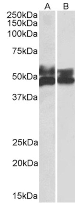 Invitrogen FCRL1 Polyclonal Antibody 100 &mu;g; Unconjugated:Antibodies,