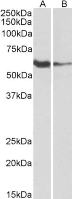 Invitrogen FCRL2 Polyclonal Antibody 100 &mu;g; Unconjugated:Antibodies,