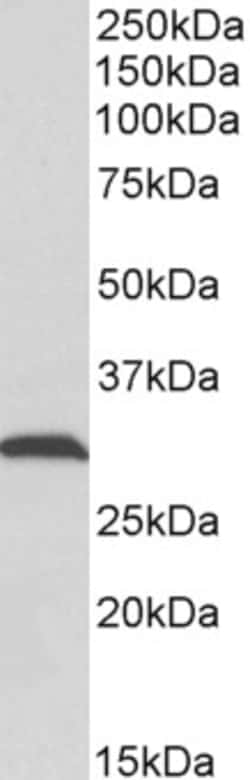 Invitrogen ATP Synthase gamma Polyclonal Antibody 100 &mu;g; Unconjugated:Antibodies,