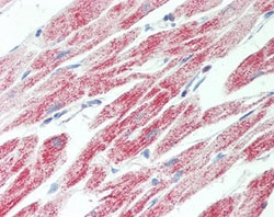 Invitrogen ATP Synthase gamma Polyclonal Antibody 100 &mu;g; Unconjugated:Antibodies,