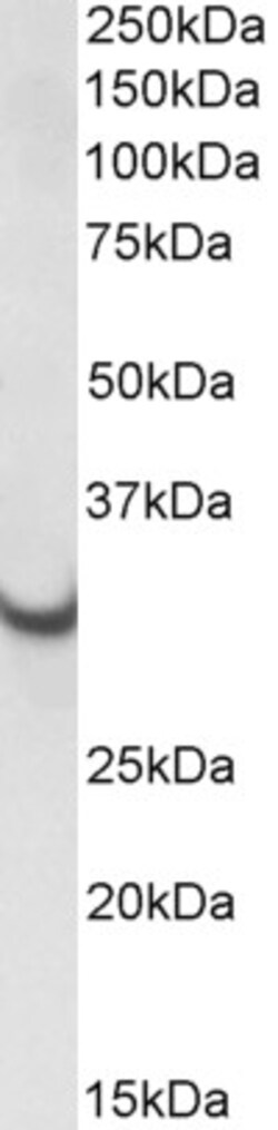 Invitrogen ATP Synthase gamma Polyclonal Antibody 100 &mu;g; Unconjugated:Antibodies,