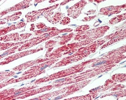 Invitrogen ATP Synthase B1 Polyclonal Antibody 100 &mu;g; Unconjugated:Antibodies,