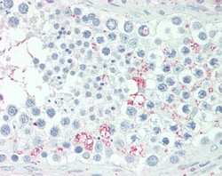 Invitrogen ADIG Polyclonal Antibody 100 &mu;g; Unconjugated:Antibodies,