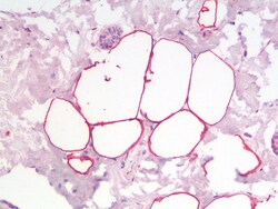 Invitrogen PLIN4 Polyclonal Antibody 100 &mu;g; Unconjugated:Antibodies,