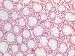 Invitrogen BMI-1 Polyclonal Antibody 100 &mu;g; Unconjugated:Antibodies,