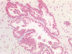 Invitrogen BMI-1 Polyclonal Antibody 100 &mu;g; Unconjugated:Antibodies,