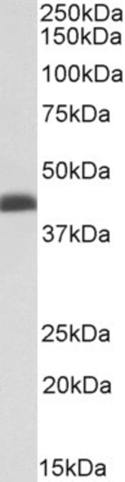 Invitrogen BMI-1 Polyclonal Antibody 100 &mu;g; Unconjugated:Antibodies,