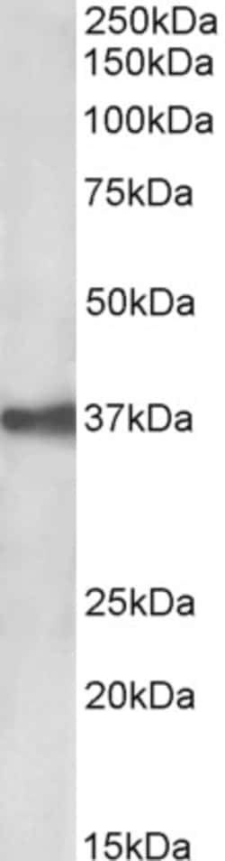 Invitrogen EpCAM (CD326) Polyclonal Antibody 100 &mu;g; Unconjugated:Antibodies,