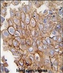 Invitrogen Annexin A2 Polyclonal Antibody 400 μL; Unconjugated:Antibodies,