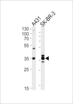 Invitrogen Annexin A2 Polyclonal Antibody 400 μL; Unconjugated:Antibodies,