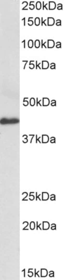Invitrogen CX3CL1 Polyclonal Antibody 100 &mu;g; Unconjugated:Antibodies,