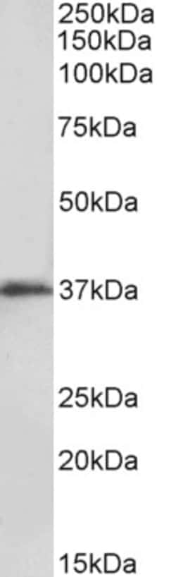 Invitrogen MSI2 Polyclonal Antibody 100 &mu;g; Unconjugated:Antibodies,