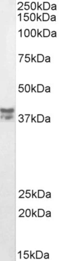 Invitrogen MSI2 Polyclonal Antibody 100 &mu;g; Unconjugated:Antibodies,
