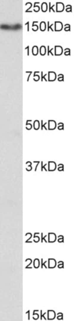 Invitrogen CD13 Polyclonal Antibody 100 &mu;g; Unconjugated:Antibodies,