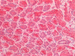 Invitrogen AMACR Polyclonal Antibody 100 &mu;g; Unconjugated:Antibodies,