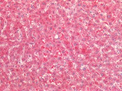 Invitrogen AMACR Polyclonal Antibody 100 &mu;g; Unconjugated:Antibodies,