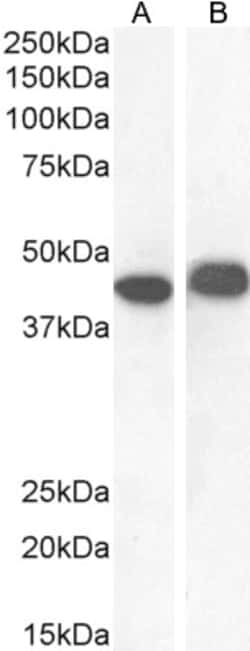Invitrogen AMACR Polyclonal Antibody 100 &mu;g; Unconjugated:Antibodies,