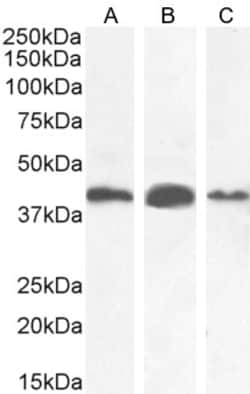 Invitrogen AMACR Polyclonal Antibody 100 &mu;g; Unconjugated:Antibodies,