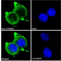 Invitrogen beta Catenin Polyclonal Antibody 100 &mu;g; Unconjugated:Antibodies,
