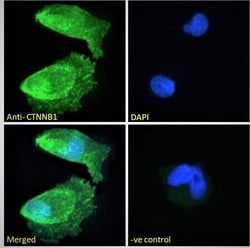 Invitrogen beta Catenin Polyclonal Antibody 100 &mu;g; Unconjugated:Antibodies,