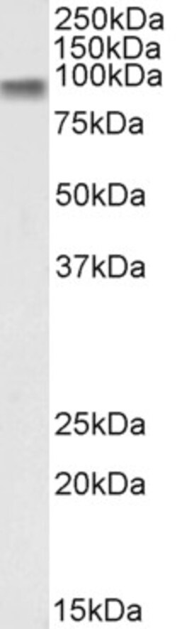 Invitrogen beta Catenin Polyclonal Antibody 100 &mu;g; Unconjugated:Antibodies,