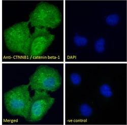 Invitrogen beta Catenin Polyclonal Antibody 100 μg; Unconjugated:Antibodies,