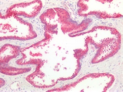 Invitrogen beta Catenin Polyclonal Antibody 100 μg; Unconjugated:Antibodies,