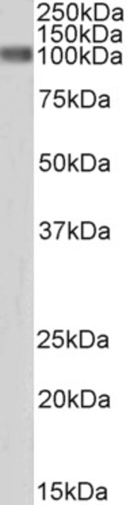 Invitrogen beta Catenin Polyclonal Antibody 100 μg; Unconjugated:Antibodies,
