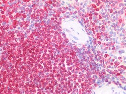 Invitrogen CD74 Polyclonal Antibody 100 &mu;g; Unconjugated:Antibodies,