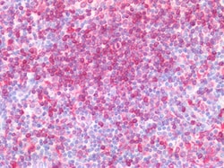 Invitrogen CD74 Polyclonal Antibody 100 &mu;g; Unconjugated:Antibodies,