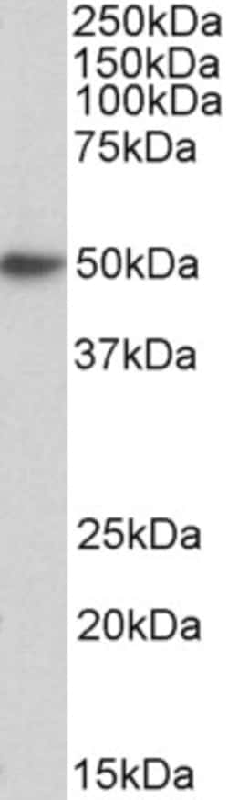 Invitrogen FceR1 alpha Polyclonal Antibody 100 &mu;g; Unconjugated:Antibodies,