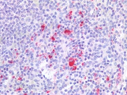 Invitrogen CD18 Polyclonal Antibody 100 &mu;g; Unconjugated:Antibodies,