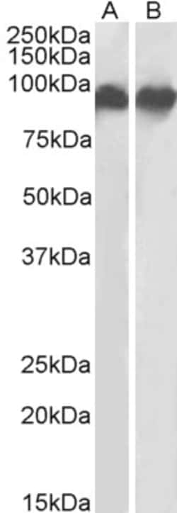 Invitrogen CD18 Polyclonal Antibody 100 &mu;g; Unconjugated:Antibodies,