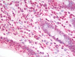 Invitrogen Nucleostemin Polyclonal Antibody 100 μg; Unconjugated:Antibodies,