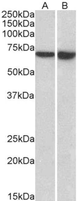 Invitrogen L-Plastin Polyclonal Antibody 100 &mu;g; Unconjugated:Antibodies,