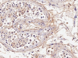 Invitrogen Acrosin Light Chain Polyclonal Antibody 100 &mu;g | Buy Online | Invitrogen&trade; | Fisher Scientific