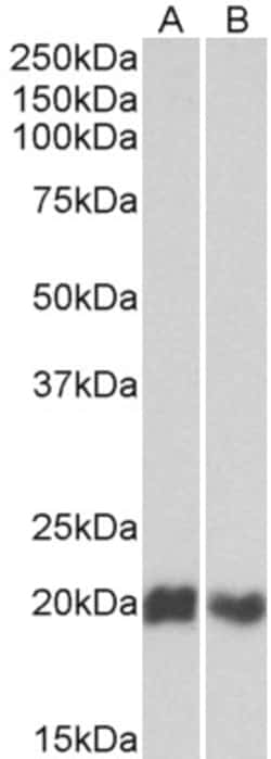 Invitrogen CD3d Polyclonal Antibody 100 &mu;g; Unconjugated:Antibodies,