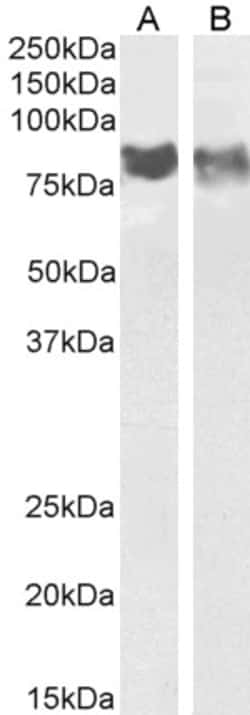 Invitrogen CD31 (PECAM-1) Polyclonal Antibody 100 &mu;g; Unconjugated:Antibodies,