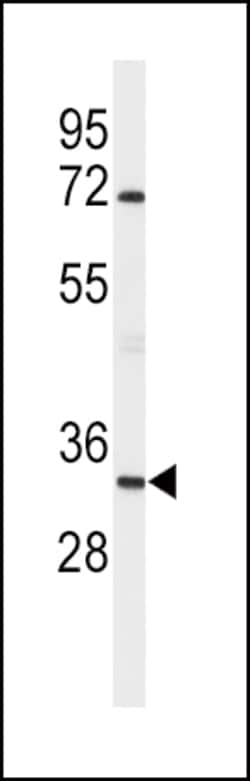 Invitrogen Apolipoprotein D Polyclonal Antibody 400 &mu;L; Unconjugated:Antibodies,