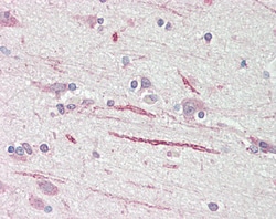 Invitrogen ASIC1 Polyclonal Antibody 100 &mu;g; Unconjugated:Antibodies,