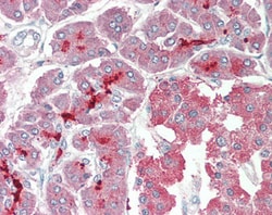 Invitrogen ASIC1 Polyclonal Antibody 100 &mu;g; Unconjugated:Antibodies,