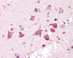 Invitrogen GPIP137 Polyclonal Antibody 100 &mu;g; Unconjugated:Antibodies,