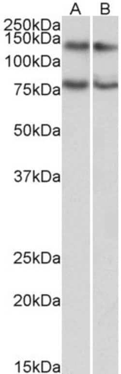 Invitrogen GPIP137 Polyclonal Antibody 100 &mu;g; Unconjugated:Antibodies,