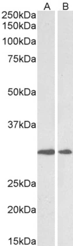 Invitrogen LOX Polyclonal Antibody 100 &mu;g; Unconjugated:Antibodies,