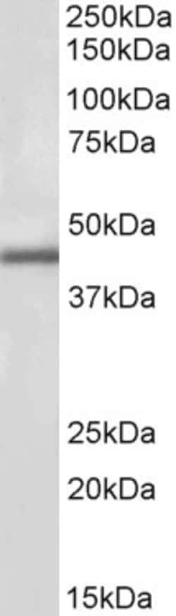 Invitrogen IP6K3 Polyclonal Antibody 100 &mu;g; Unconjugated:Antibodies,