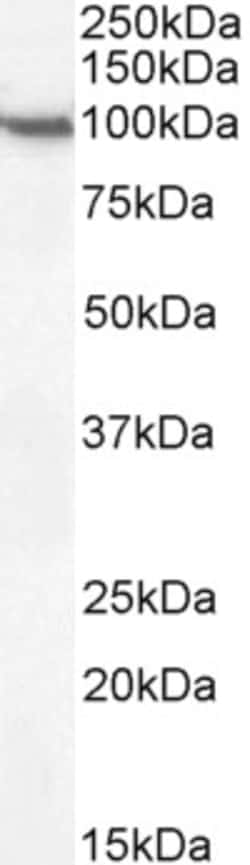 Invitrogen CD68 Polyclonal Antibody 100 &mu;g; Unconjugated:Antibodies,
